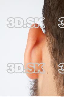 Ear texture of Charlie 0001